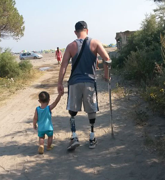 man with prosthetic legs walking with child to beach