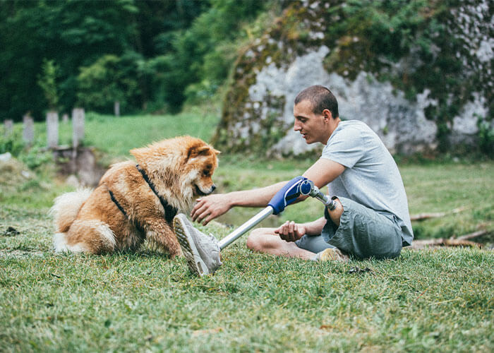 Man with prosthetic leg playing with his dog