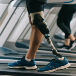 Person with prosthetic leg walking on treadmill.