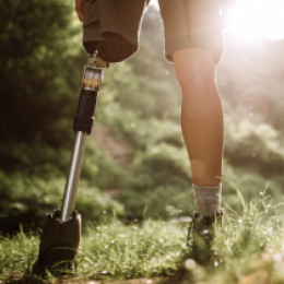 Image of a person outside with has a prosthetic leg.