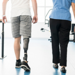 Photo of a man with prosthetic walking with a prosthesist.