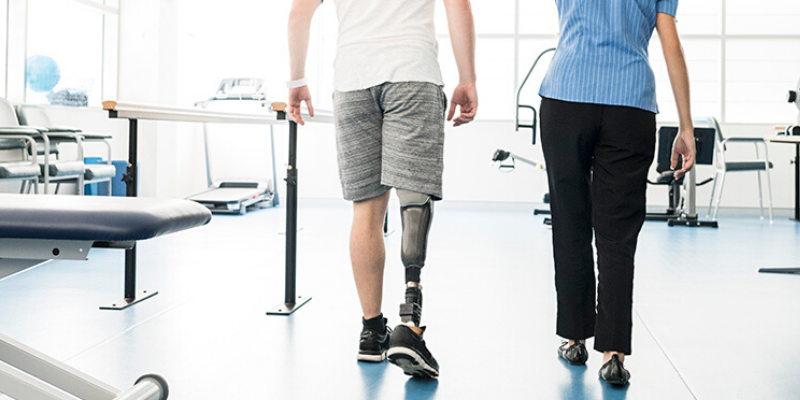 woman below knee prosthetic leg